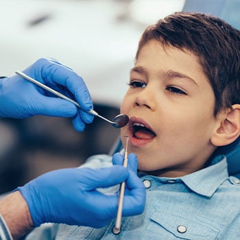 White Tooth-Colored Fillings at North Shore Smiles
