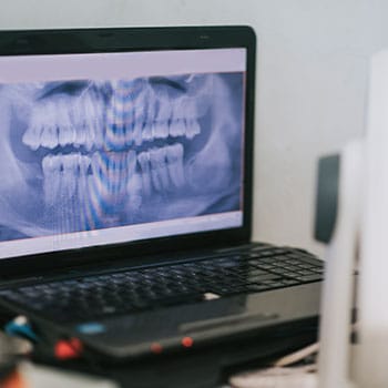 Digital X-rays at North Shore Smiles